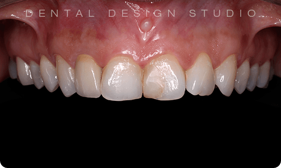 general dentistry in cancun